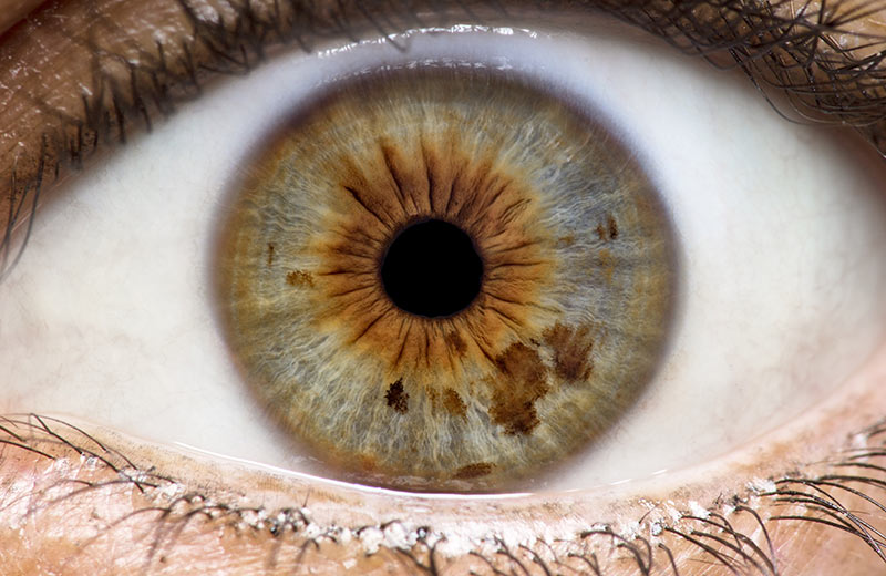 iridology-it-s-all-in-the-eyes-centre-of-excellence