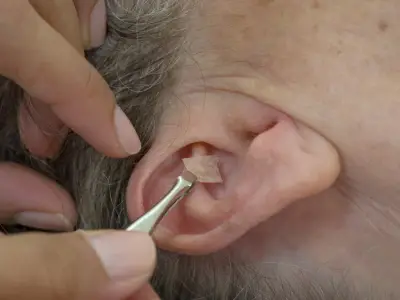 Ear Seeds: Benefits, Safety, and How to Use Them Effectively